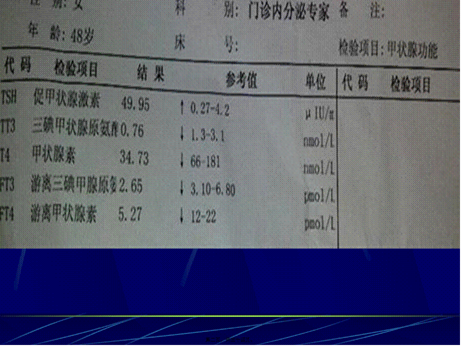 2022年医学专题—甲状腺功能检查及意义.ppt_第2页