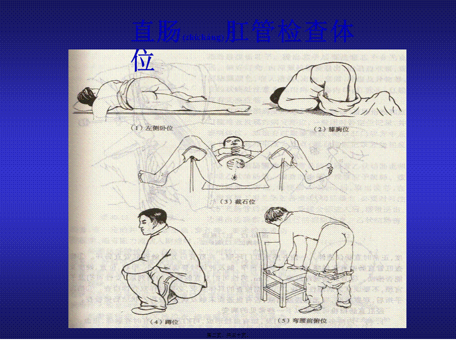 2022年医学专题—肛门直肠的检查方法.ppt_第2页