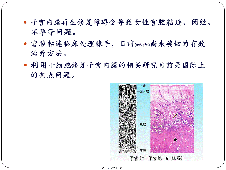 2022年医学专题—干细胞在子宫内膜损伤修复中的应用.pptx_第2页