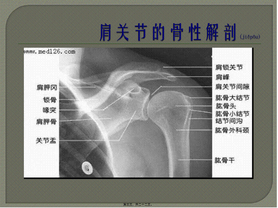 2022年医学专题—肩关节肩袖撕裂.pptx_第3页