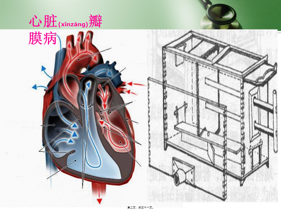 2022年医学专题—心脏瓣膜病郭武(1).ppt_第2页