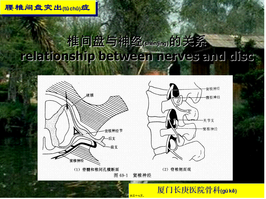 2022年医学专题—腰腿痛-Low-Back-Pain---厦门长庚医院---XIAMEN-CHANG.ppt_第3页