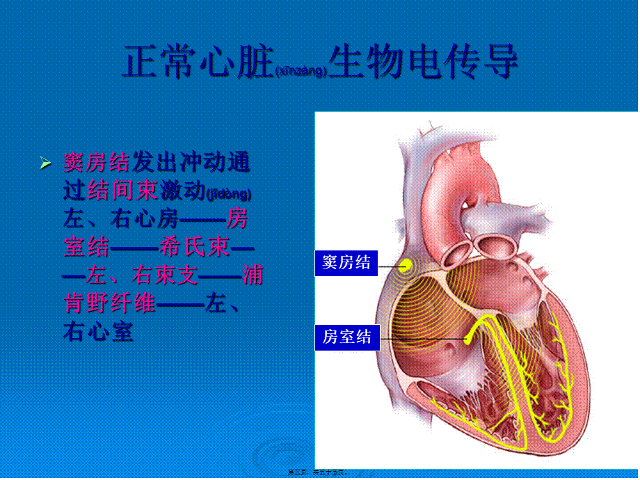 2022年医学专题—人工心脏起搏器.ppt_第3页