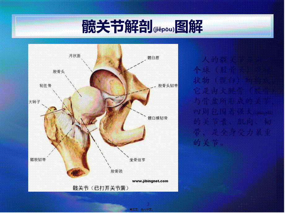 2022年医学专题—人工髋关节置换术(ppt).ppt_第3页