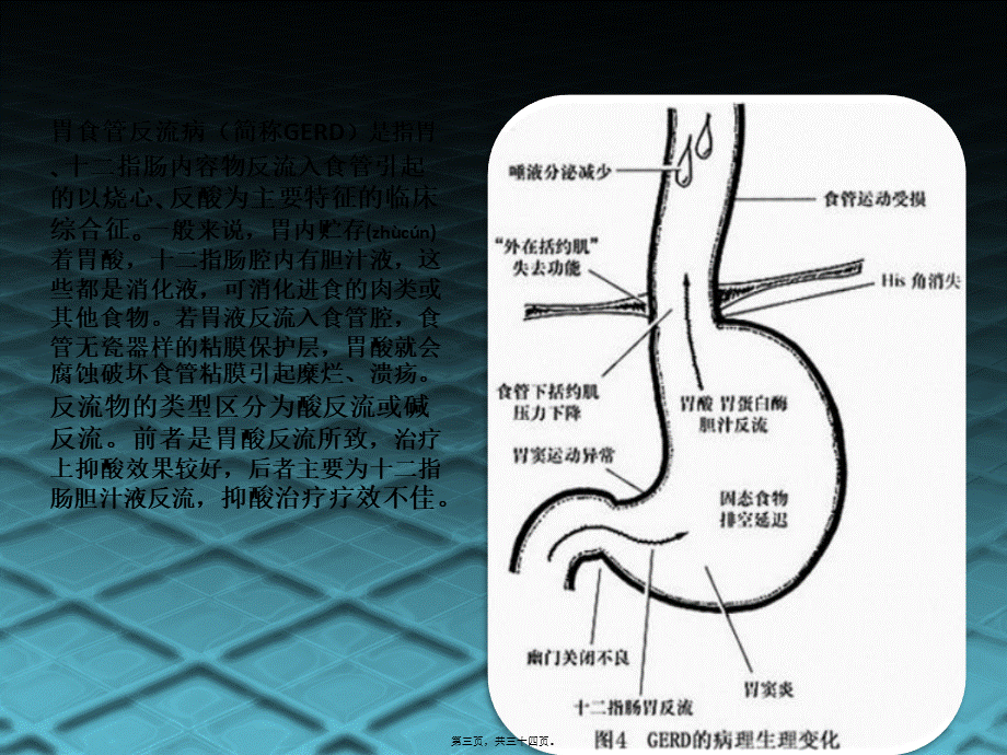 2022年医学专题—消化系统常见病及用药.pptx_第3页