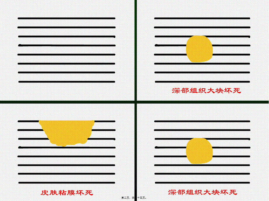 2022年医学专题—第三讲-局部血液循环障碍(1).ppt_第2页