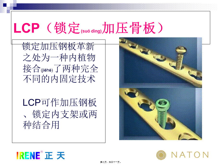 2022年医学专题—LCP系统接骨板的注意问题及常见问题(免金币).ppt_第2页