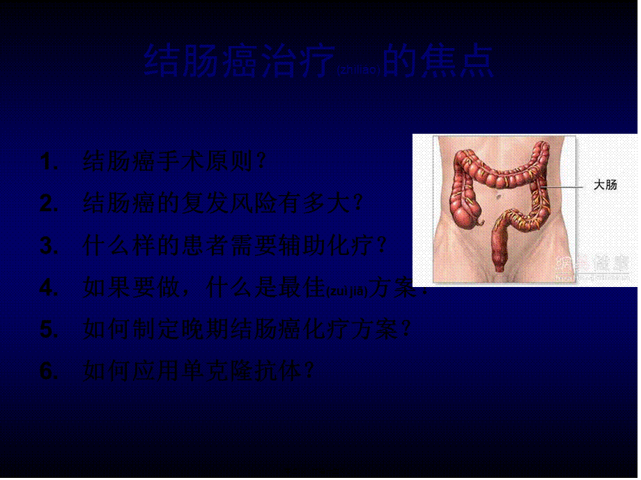 2022年医学专题—结肠癌诊治规范-李进.ppt.ppt_第2页