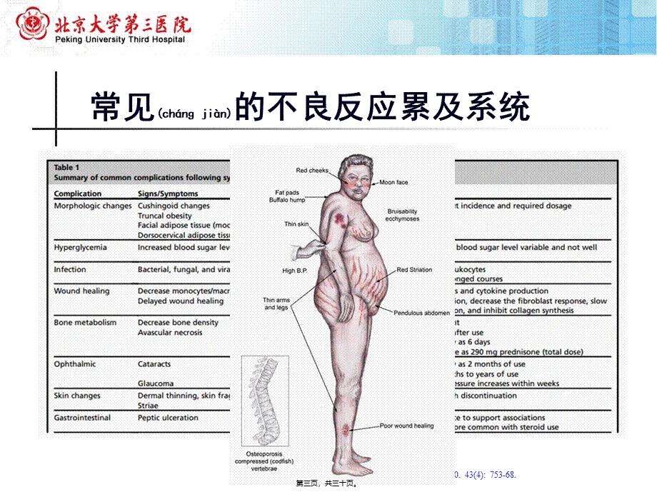 2022年医学专题—糖皮质激素不良反应概述北医三院.pptx_第3页