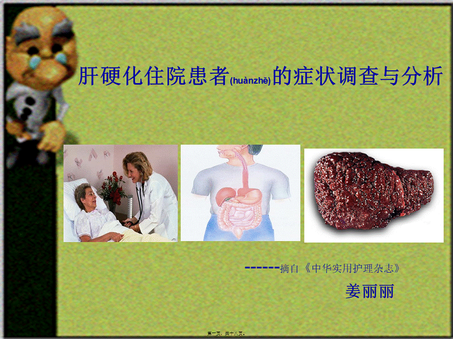 2022年医学专题—肝硬化住院患者的调查与分析宣讲.ppt_第1页