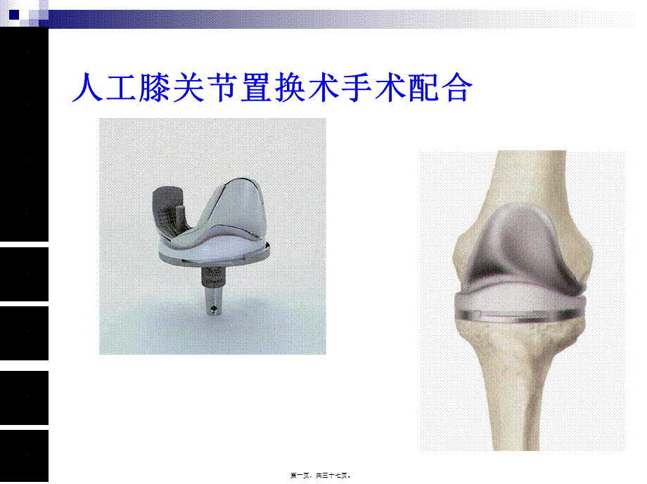 人工膝关节置换术手术配合ppt..pptx_第1页