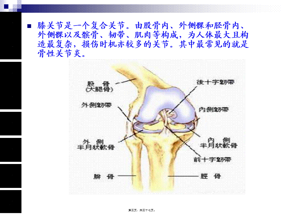 人工膝关节置换术手术配合ppt..pptx_第3页