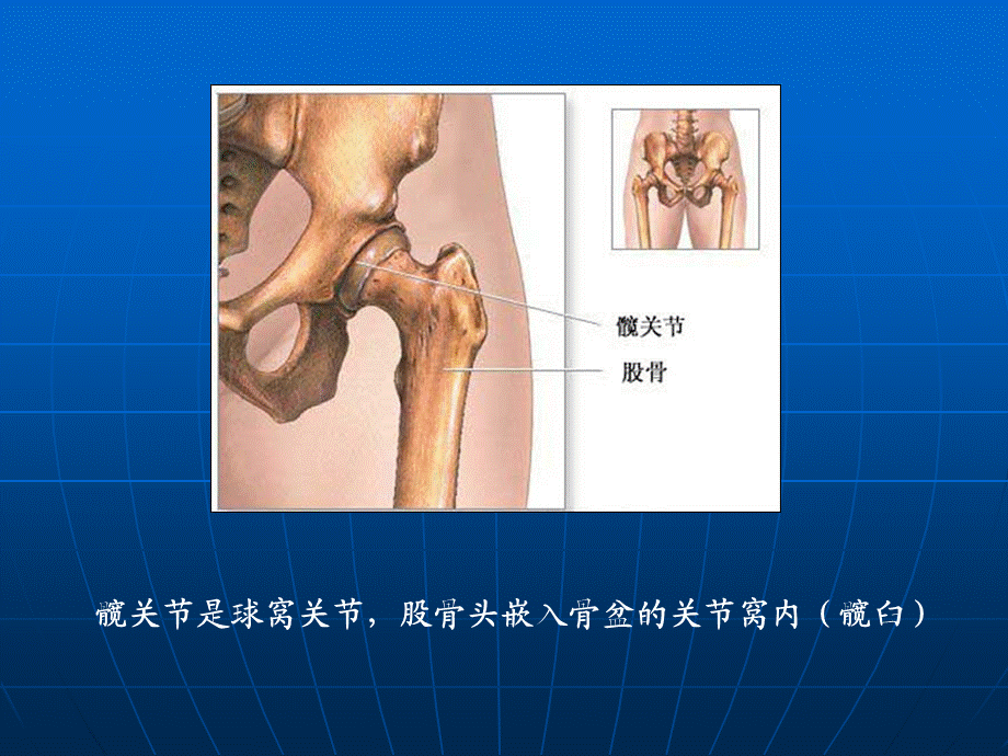 全髋关节置换术后康复训练修订版摘要.ppt_第3页