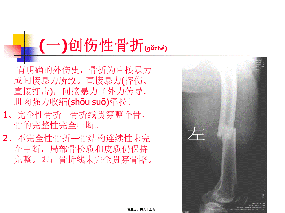 2022年医学专题—第四章、骨关节损伤2.ppt_第3页