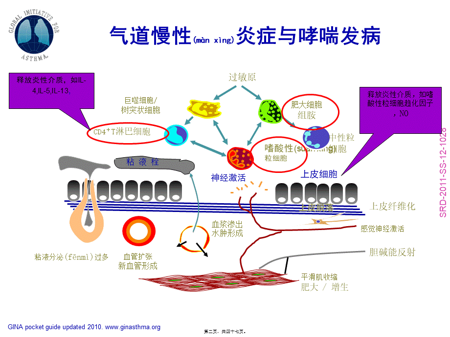 2022年医学专题—支气管哮喘指南解读(1).ppt_第2页