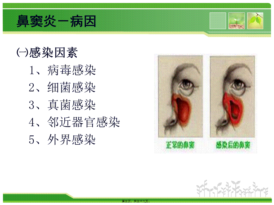 五官科常见病例及诊治.pptx_第3页