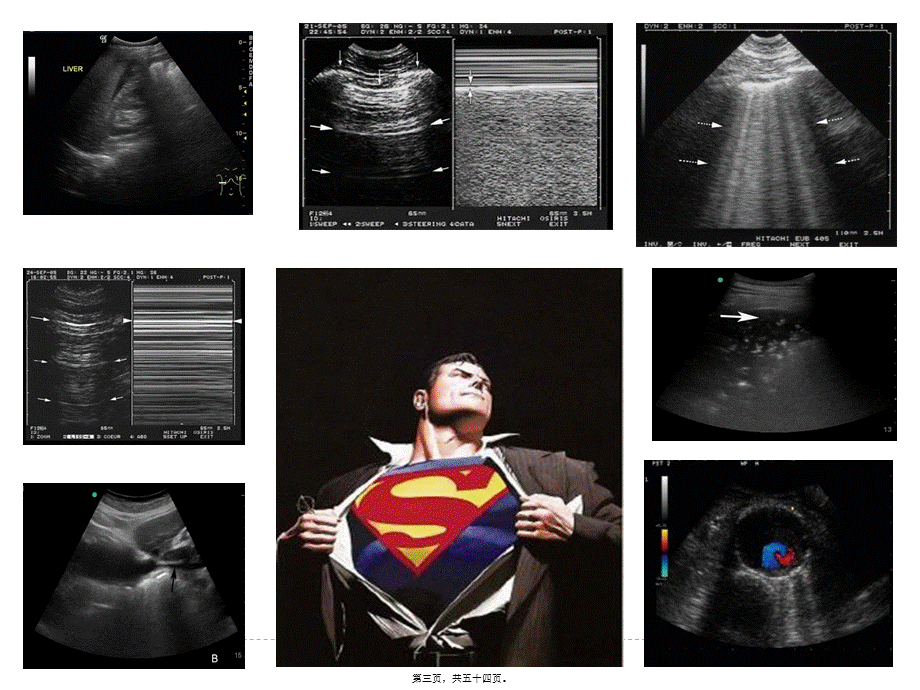 2022年医学专题—急诊床旁超声的应用详解(1).ppt_第3页
