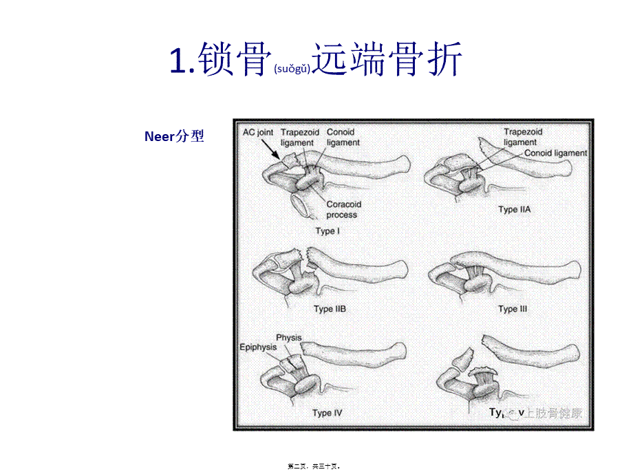 2022年医学专题—上肢骨折分型.pptx_第2页