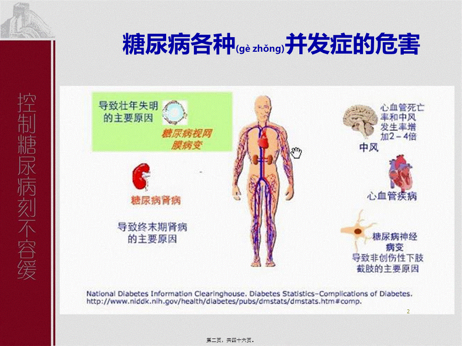 2022年医学专题—Part7-糖尿病并发症(三).ppt_第2页