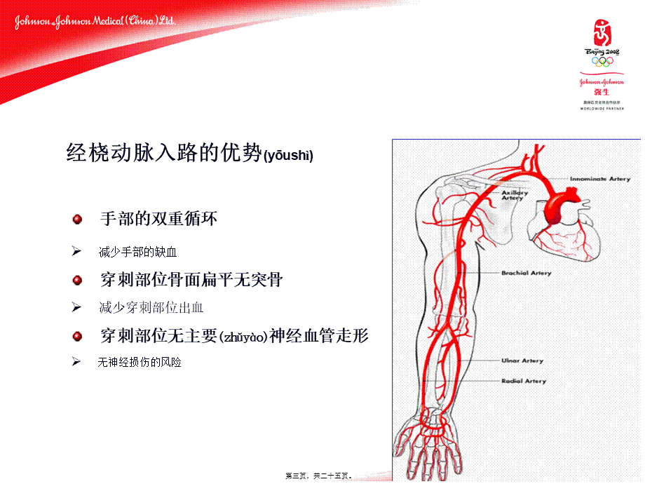 2022年医学专题—经桡动脉PCI指引导管的选择-阜外医院-姚民-1(1).ppt_第3页