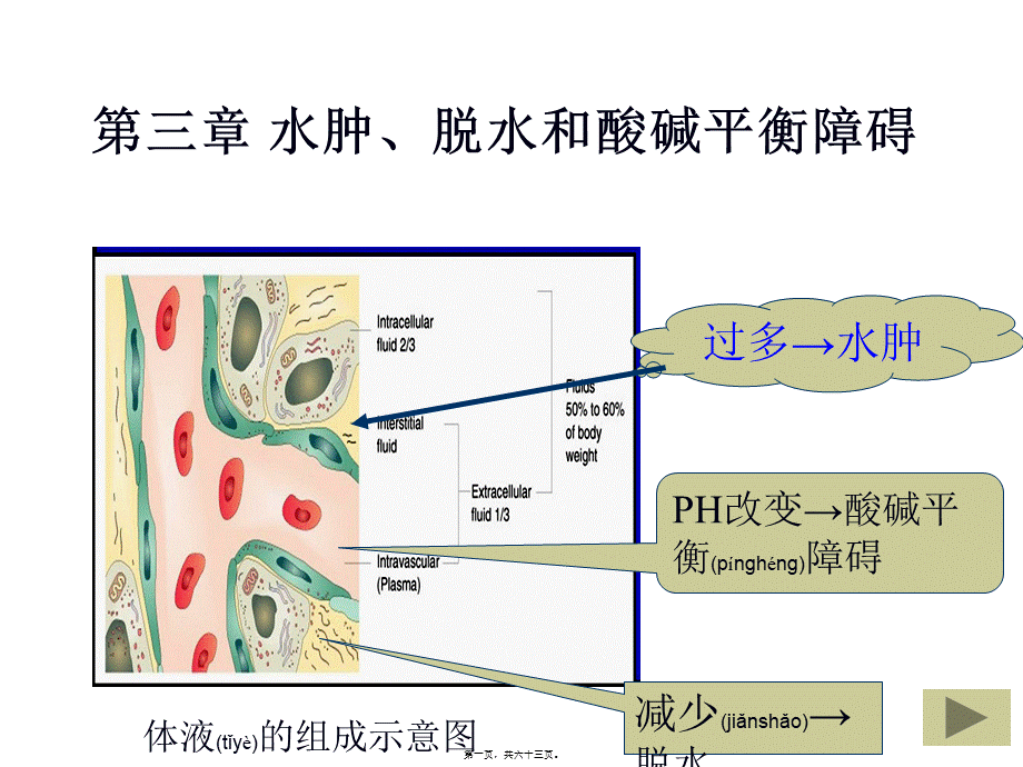 2022年医学专题—第三章水肿和脱水(1).ppt_第1页