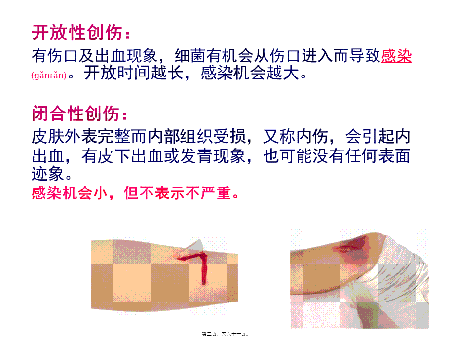 2022年医学专题—创伤的识别及处理(1).ppt_第3页