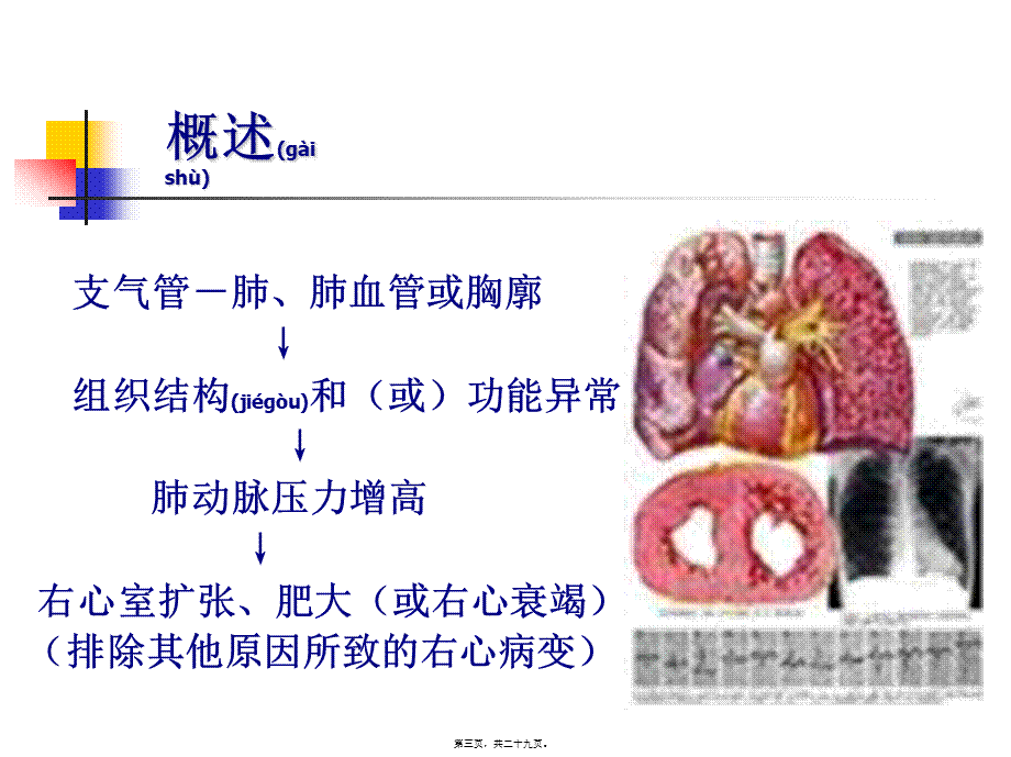 2022年医学专题—慢性肺源性心脏病讲解.ppt_第3页