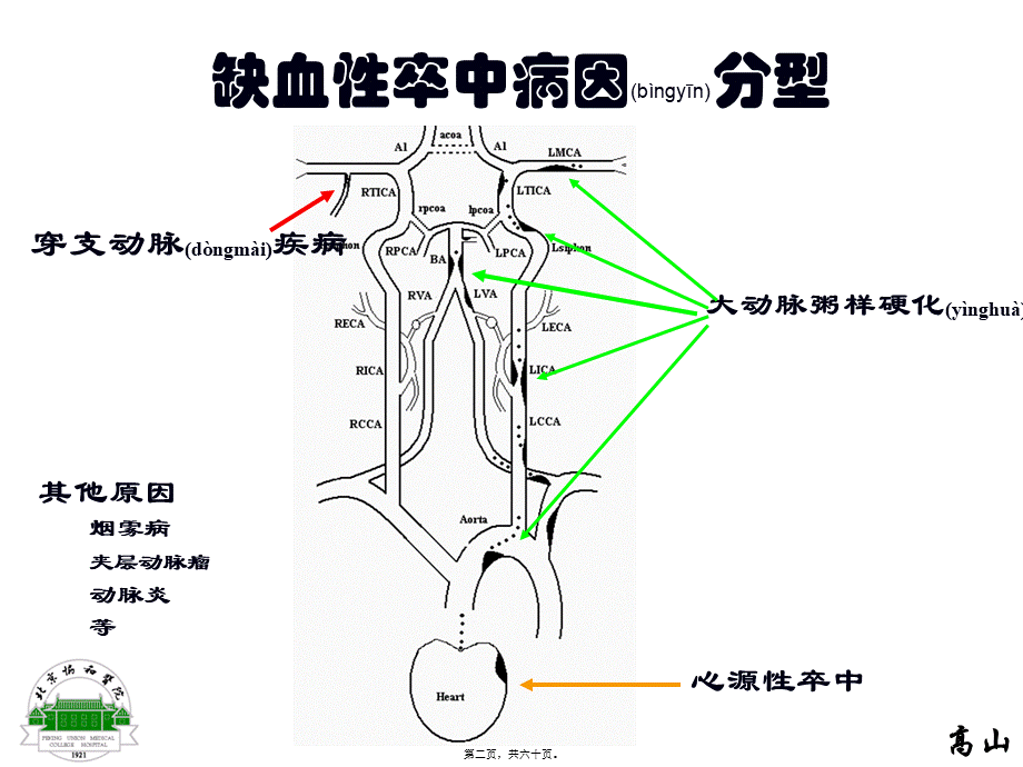 2022年医学专题—动脉粥样硬化性梗死分层病例.ppt_第2页