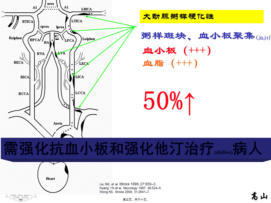 2022年医学专题—动脉粥样硬化性梗死分层病例.ppt_第3页