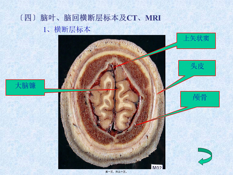 头颈部—fy.pptx_第1页