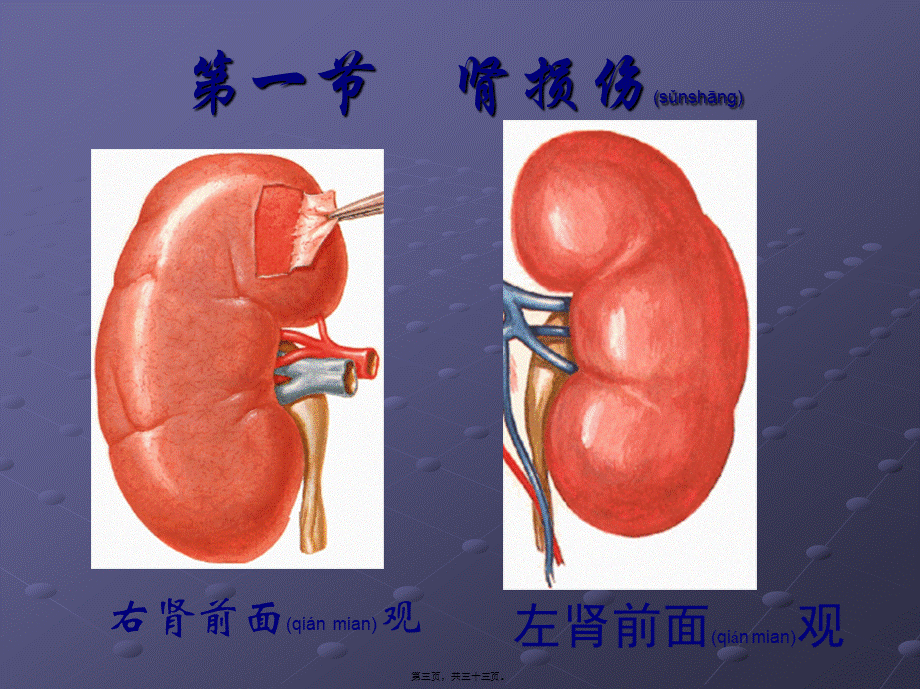 2022年医学专题—第41章泌尿系统损伤(1).ppt_第3页