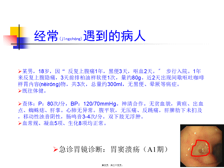 2022年医学专题—上消化道出血风险评估(2015-11-16)教程(1).ppt_第3页