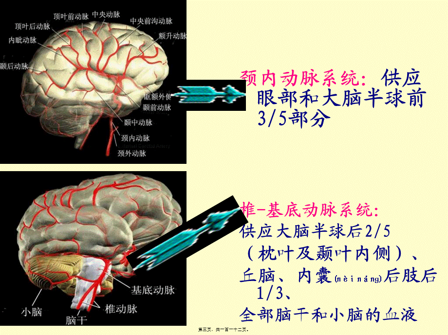 2022年医学专题—新科普高血压脑卒中.ppt_第3页