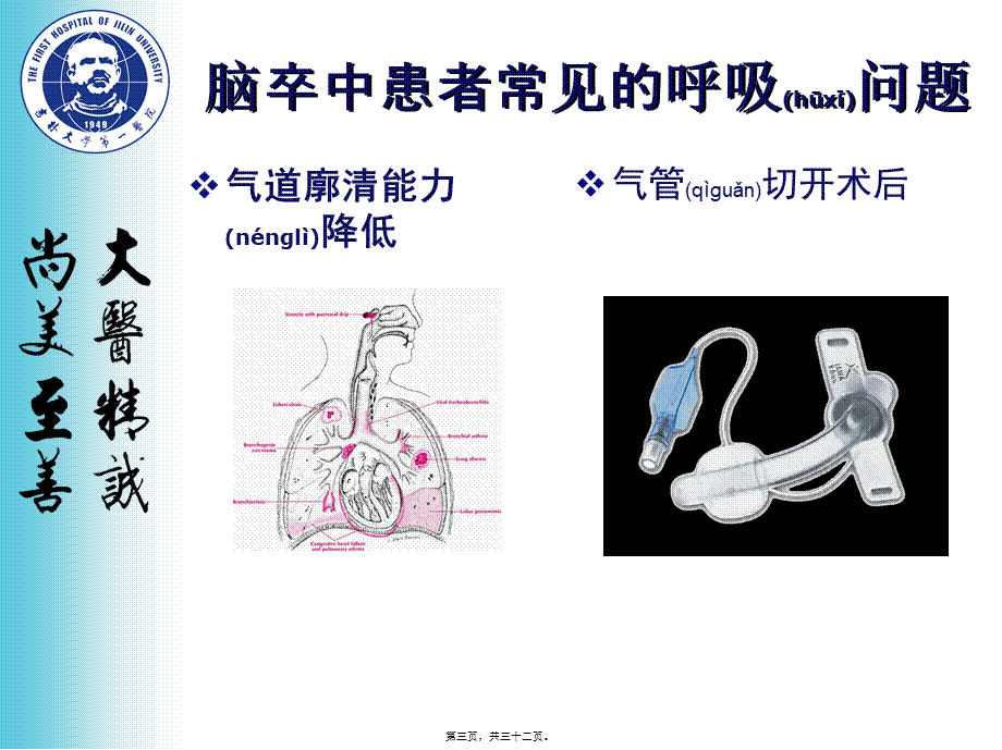 2022年医学专题—脑卒中呼吸训练.ppt_第3页