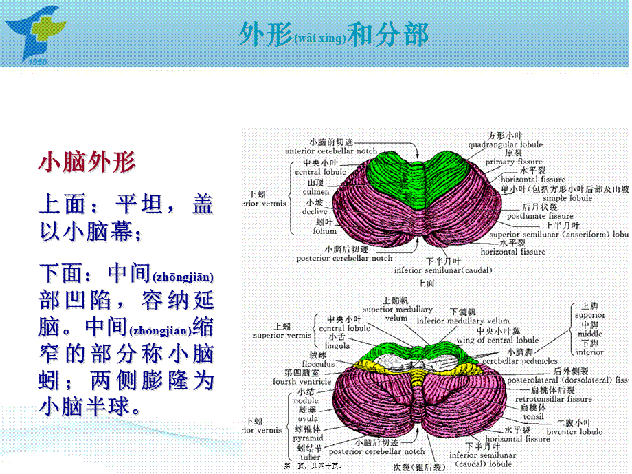 2022年医学专题—小脑出血诊疗规范(1).ppt_第3页