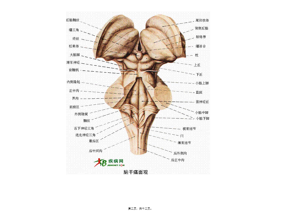 2022年医学专题—脑干出血(1).ppt_第2页