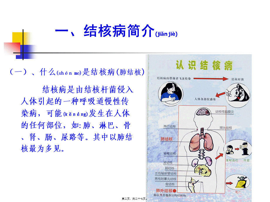 2022年医学专题—学校结核病(学生).ppt_第2页