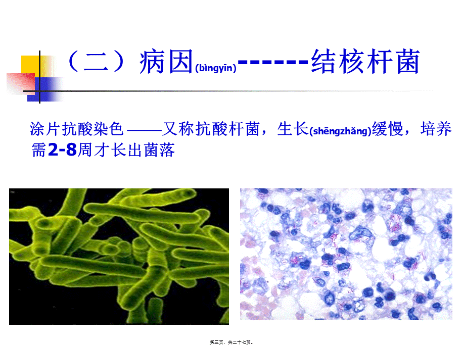 2022年医学专题—学校结核病(学生).ppt_第3页