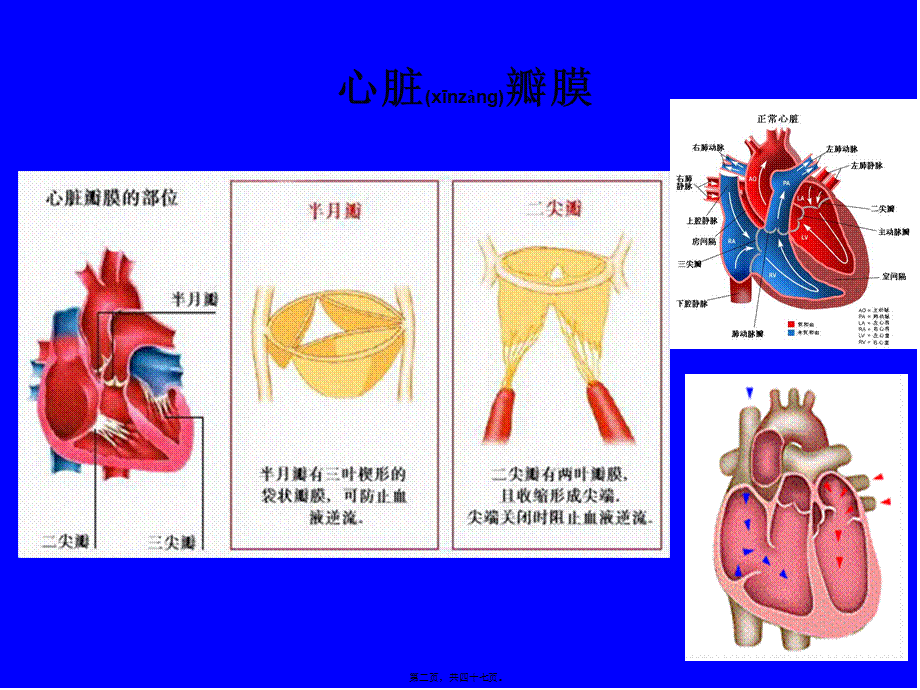 2022年医学专题—心脏瓣膜病(二尖瓣狭窄)2014.ppt_第2页