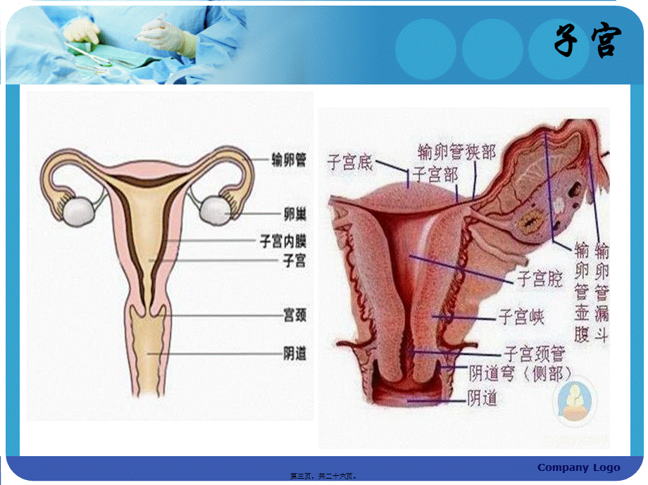 子宫内膜癌的手术配合.ppt_第3页