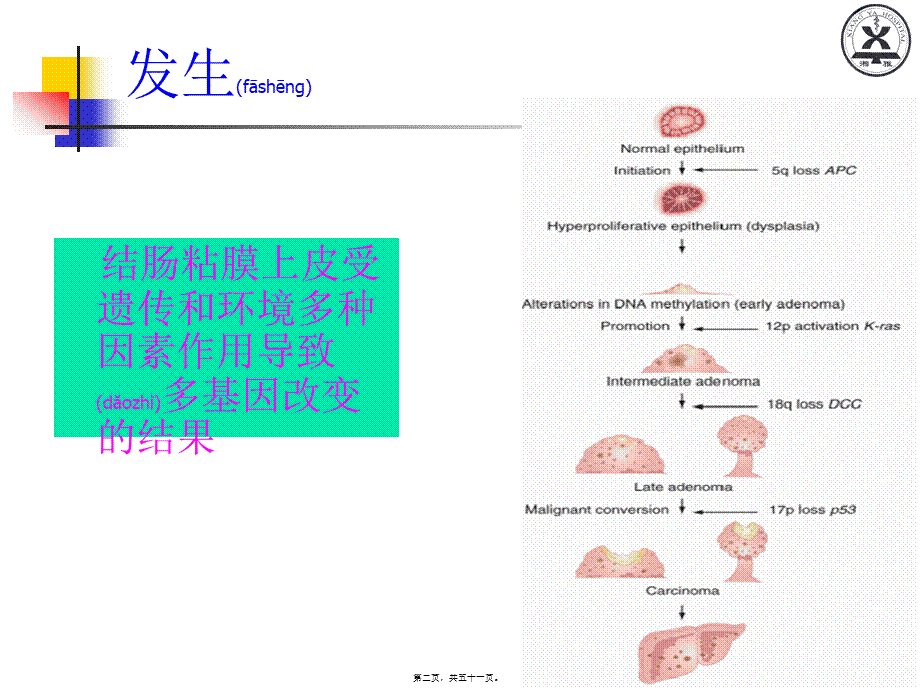 2022年医学专题—大肠癌晏教授讲义.ppt_第2页