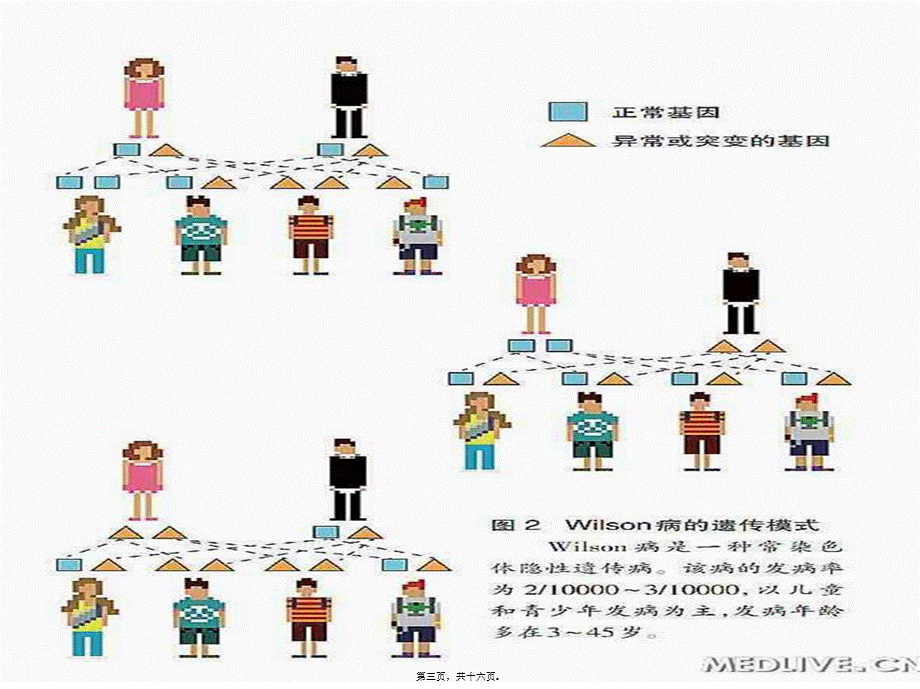 2022年医学专题—肝豆状核变性(1).ppt_第3页