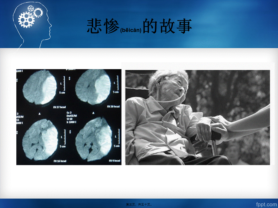 2022年医学专题—脑梗死的急救进展0309.pptx_第3页