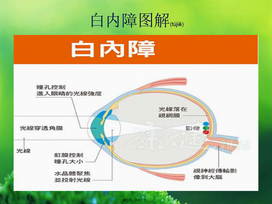 2022年医学专题—年龄相关性白内障.ppt_第2页