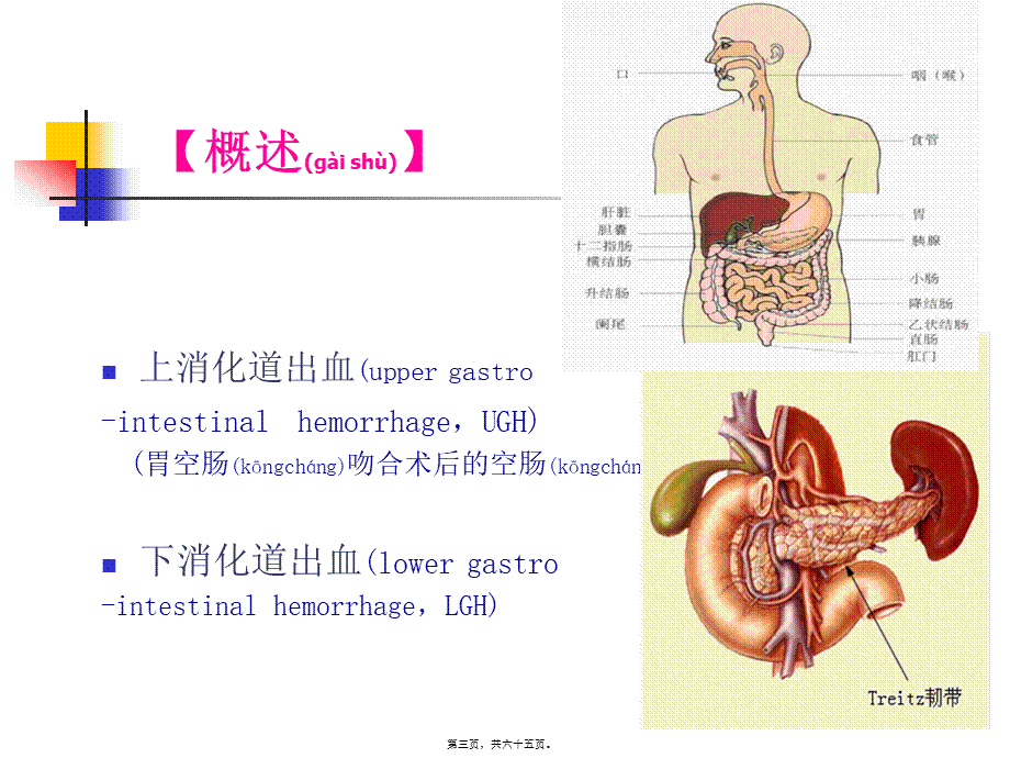 2022年医学专题—消化道出血个案苏丹.ppt_第3页