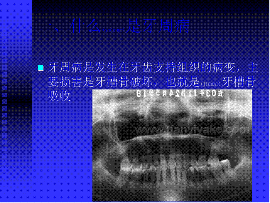 2022年医学专题—牙周健康讲座广州天一牙科诊所--刘剑(1).ppt_第1页