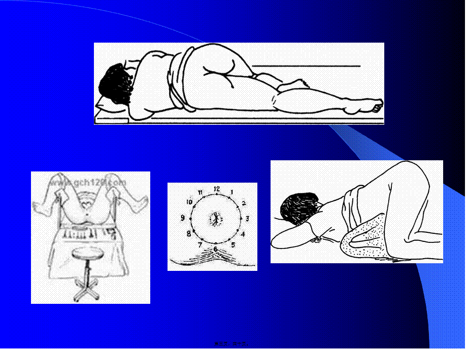 2022年医学专题—肛门、直肠和生殖器检查(1).ppt_第3页