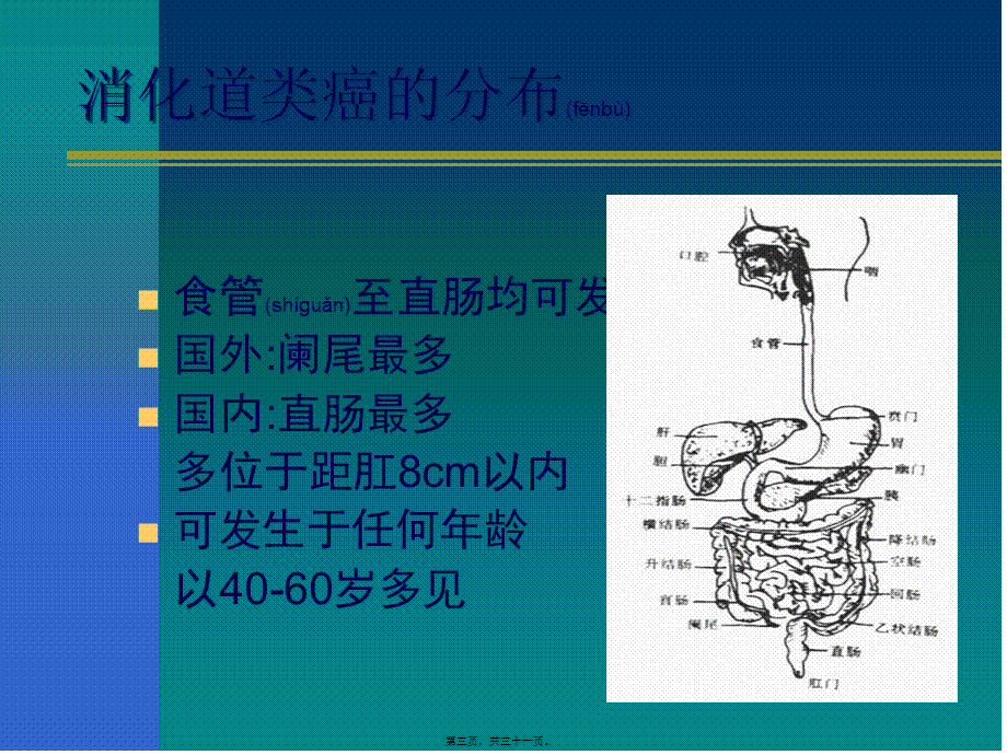 2022年医学专题—消化道类癌与类癌综合征1(1).ppt_第3页