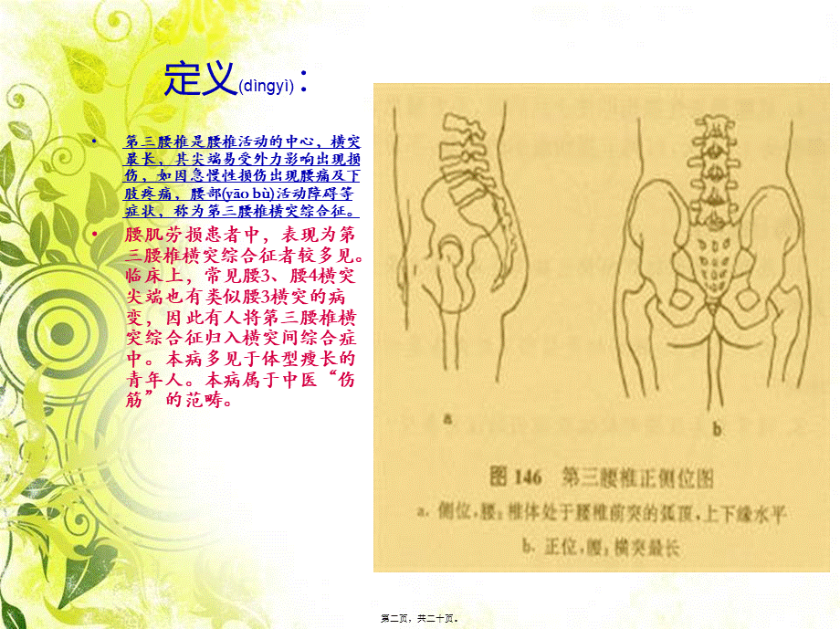 2022年医学专题—腰3横突综合症..ppt_第2页