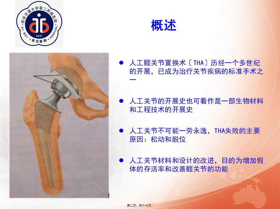 人工髋关节假体材料-马瑞.pptx_第2页